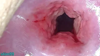 856 extreme porn videos